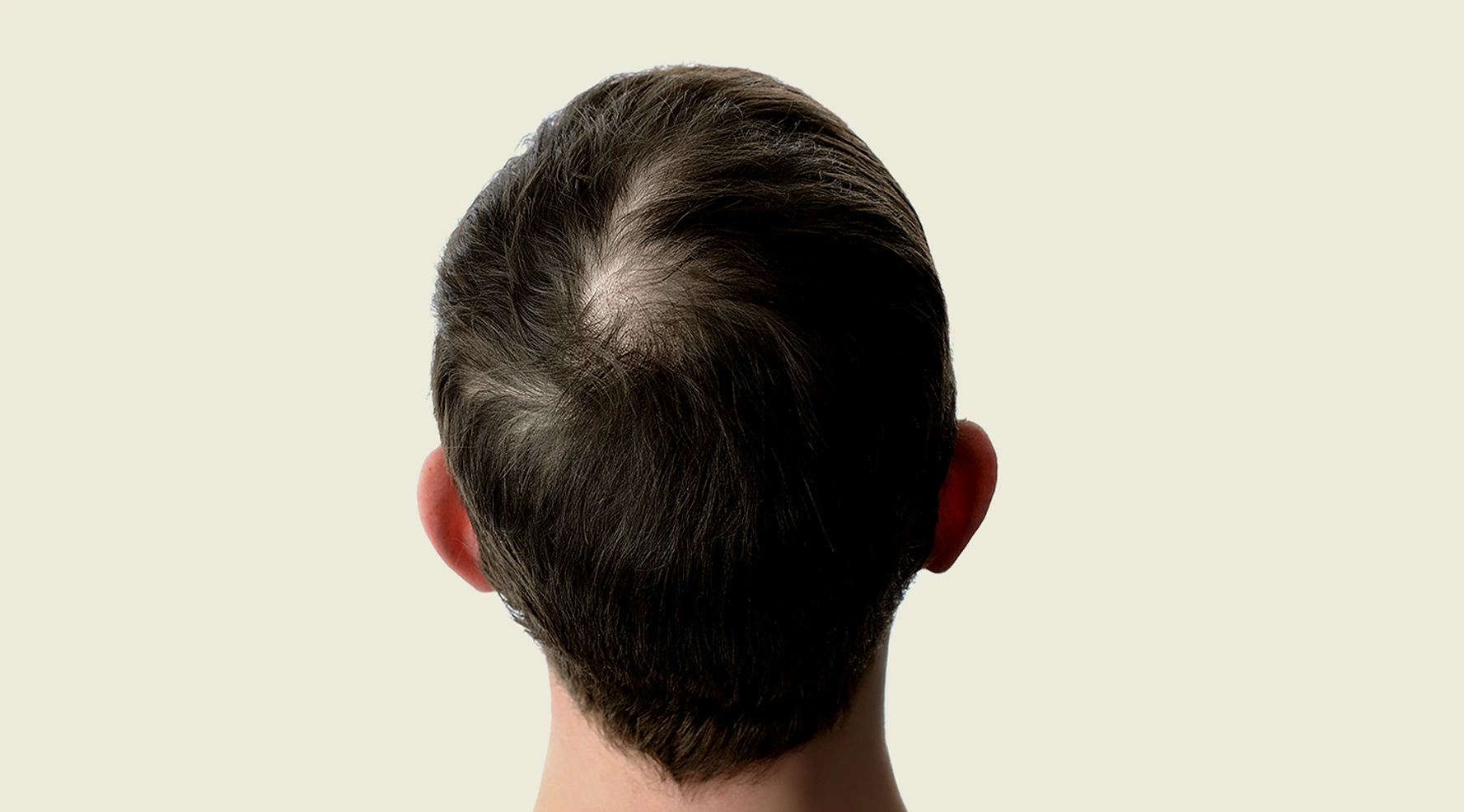 before image